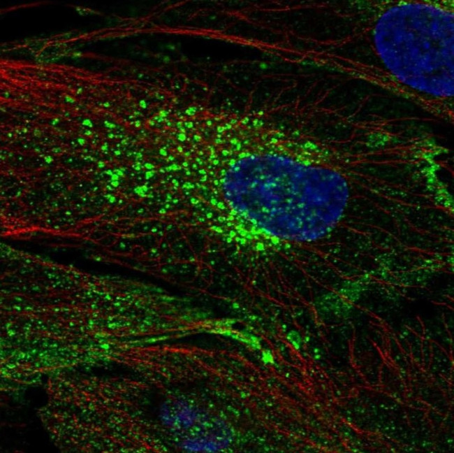 CHIC2 Antibody in Immunocytochemistry (ICC/IF)