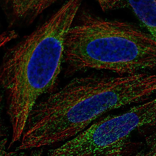 FAM62A Antibody in Immunocytochemistry (ICC/IF)