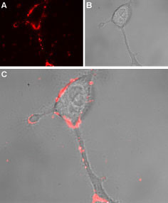 TRPA1 (extracellular) Antibody in Immunocytochemistry (ICC/IF)