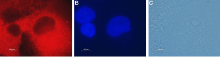 CLIC4 Antibody in Immunocytochemistry (ICC/IF)