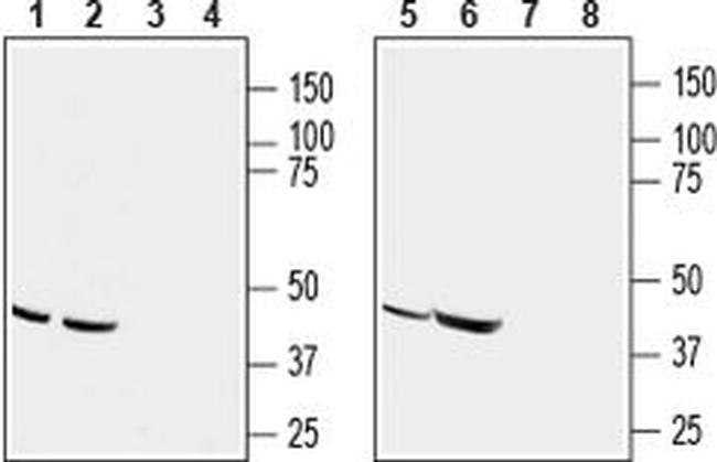 CCR9 (extracellular) Antibody in Western Blot (WB)