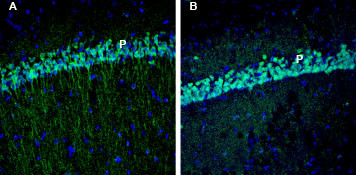 EphA3 (extracellular) Antibody in Immunohistochemistry (Frozen) (IHC (F))