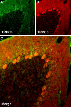 TRPC6 Antibody in Immunohistochemistry (Frozen) (IHC (F))