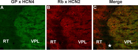 HCN4 Antibody in Immunohistochemistry (Frozen) (IHC (F))