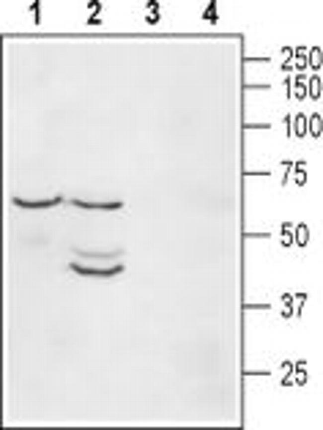 Kir2.1 (KCNJ2) Antibody in Western Blot (WB)