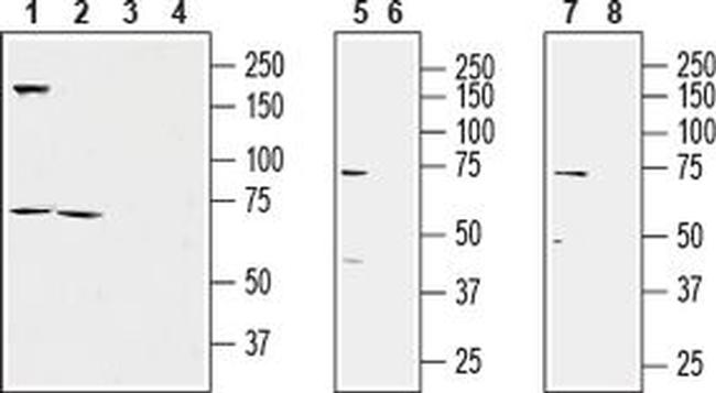 KCNQ1 Antibody in Western Blot (WB)