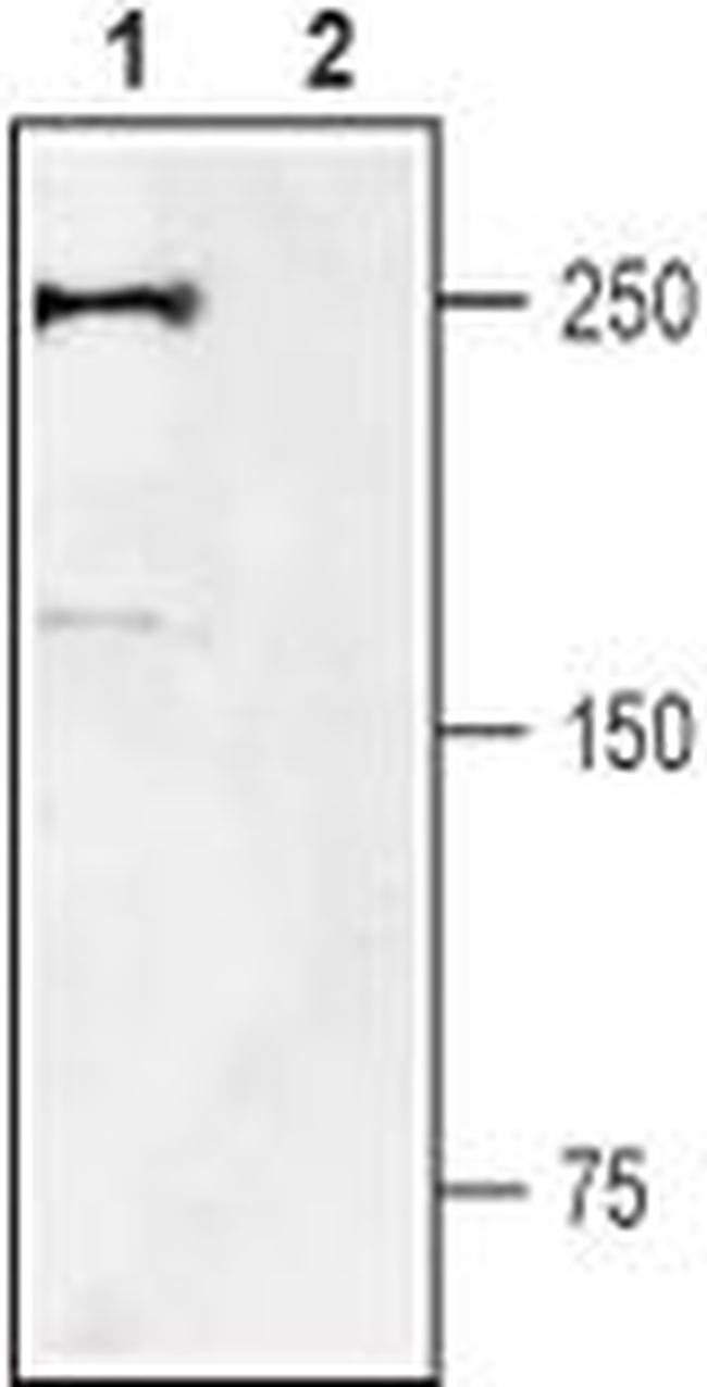 SCN9A Antibody in Western Blot (WB)