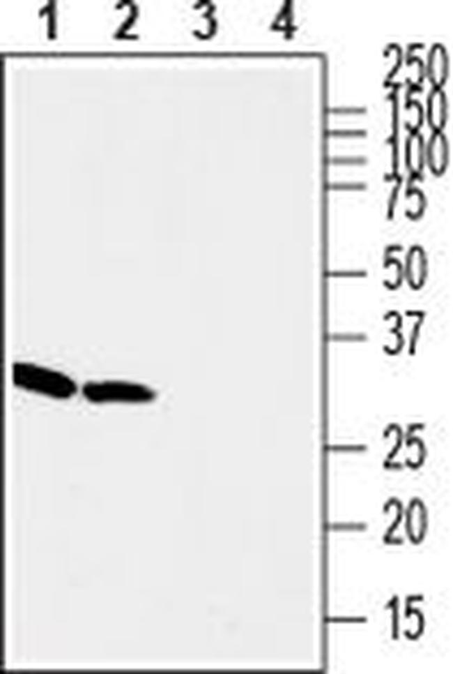 Stargazin Antibody in Western Blot (WB)