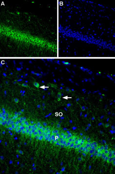 KV2.1 (KCNB1) Antibody in Immunohistochemistry (IHC)