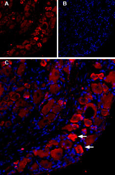 TRPV1 Antibody in Immunohistochemistry (IHC)