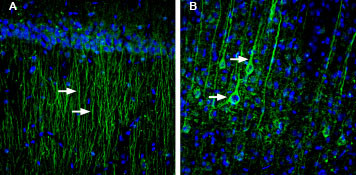 SLC6A8 Antibody in Immunohistochemistry (Frozen) (IHC (F))