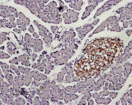 KISS1R (extracellular) Antibody in Immunohistochemistry (Paraffin) (IHC (P))