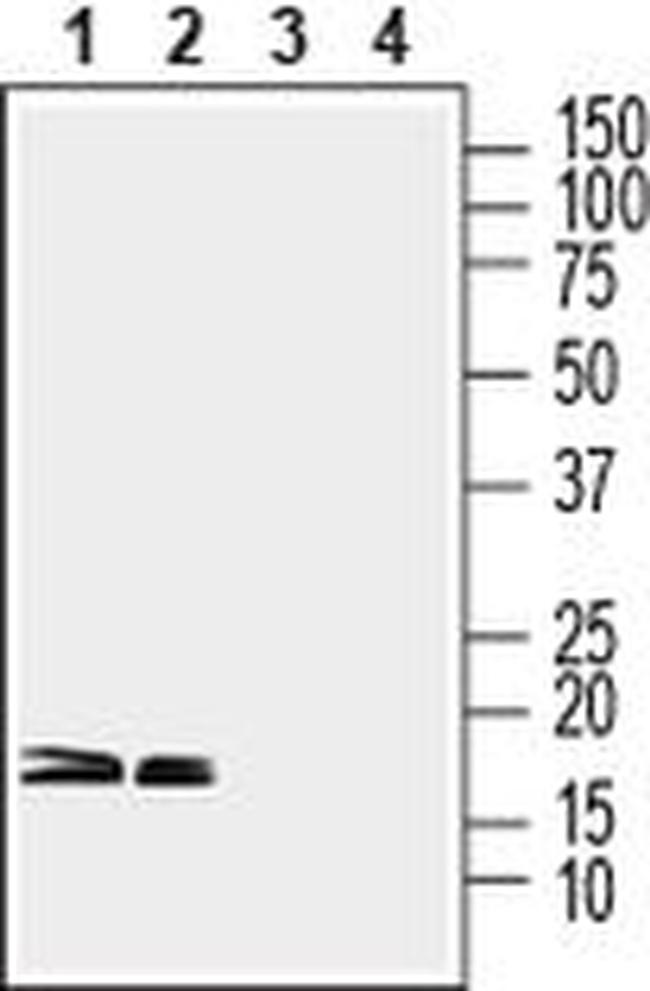 CPLX1/CPLX2 Antibody in Western Blot (WB)