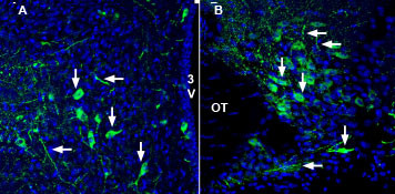 SLC17A9 Antibody in Immunohistochemistry (Frozen) (IHC (F))