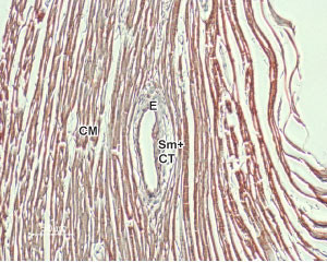 SLC8A1 Antibody in Immunohistochemistry (Paraffin) (IHC (P))