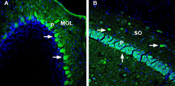 DPP10 (extracellular) Antibody in Immunohistochemistry (Frozen) (IHC (F))