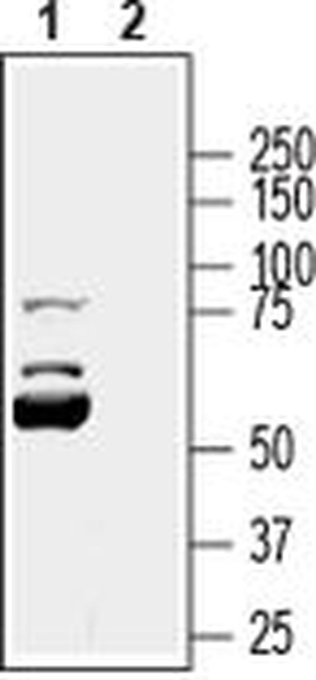 KCNK16 (extracellular) Antibody in Western Blot (WB)