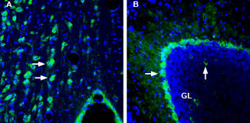 CD294 (CRTH2) (extracellular) Antibody in Immunohistochemistry (Frozen) (IHC (F))