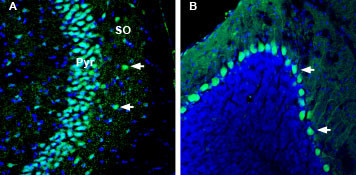 KIDINS220 Antibody in Immunohistochemistry (Frozen) (IHC (F))