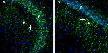 GIPC1 Antibody in Immunohistochemistry (Frozen) (IHC (F))