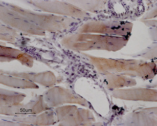 RyR1 Antibody in Immunohistochemistry (Paraffin) (IHC (P))