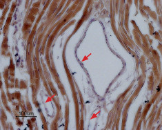 SCN5A Antibody in Immunohistochemistry (Paraffin) (IHC (P))