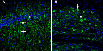 HTR1B (extracellular) Antibody in Immunohistochemistry (IHC)