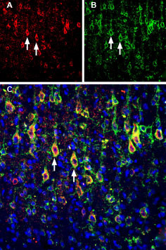 SLITRK1 (extracellular) Antibody in Immunohistochemistry (Frozen) (IHC (F))