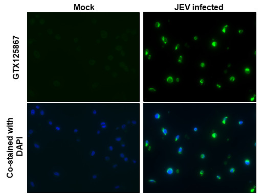 Japanese Encephalitis Envelope Protein Antibody in Immunocytochemistry (ICC/IF)