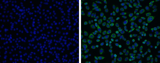 Japanese Encephalitis Virus NS3 Antibody in Immunocytochemistry (ICC/IF)