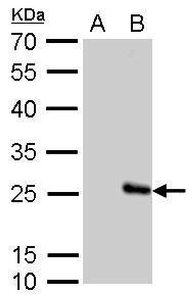 Influenza B M Antibody in Western Blot (WB)