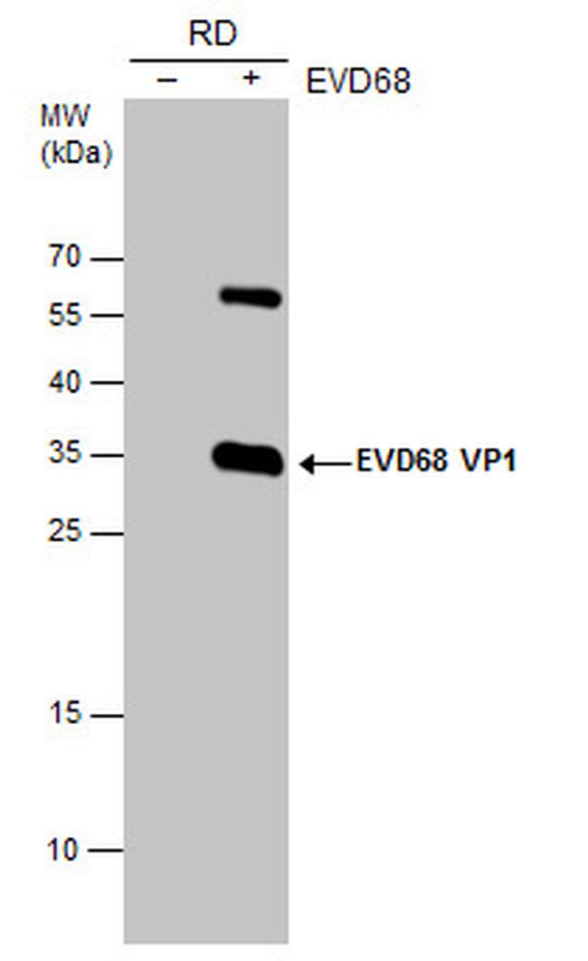 Enterovirus D68 VP1 Antibody in Western Blot (WB)