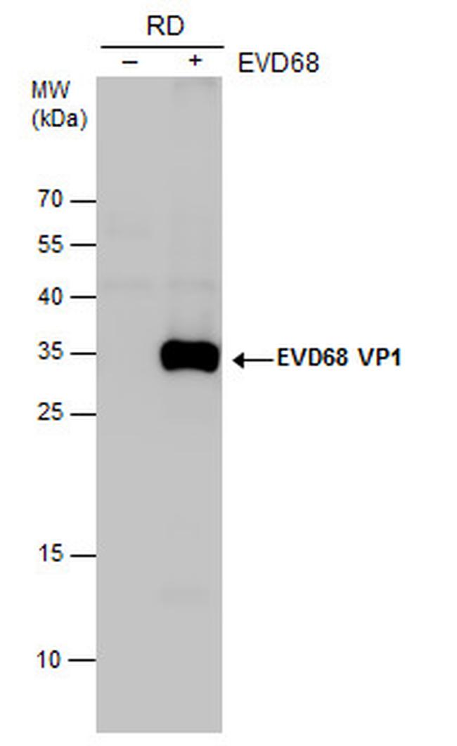 Enterovirus D68 VP1 Antibody in Western Blot (WB)