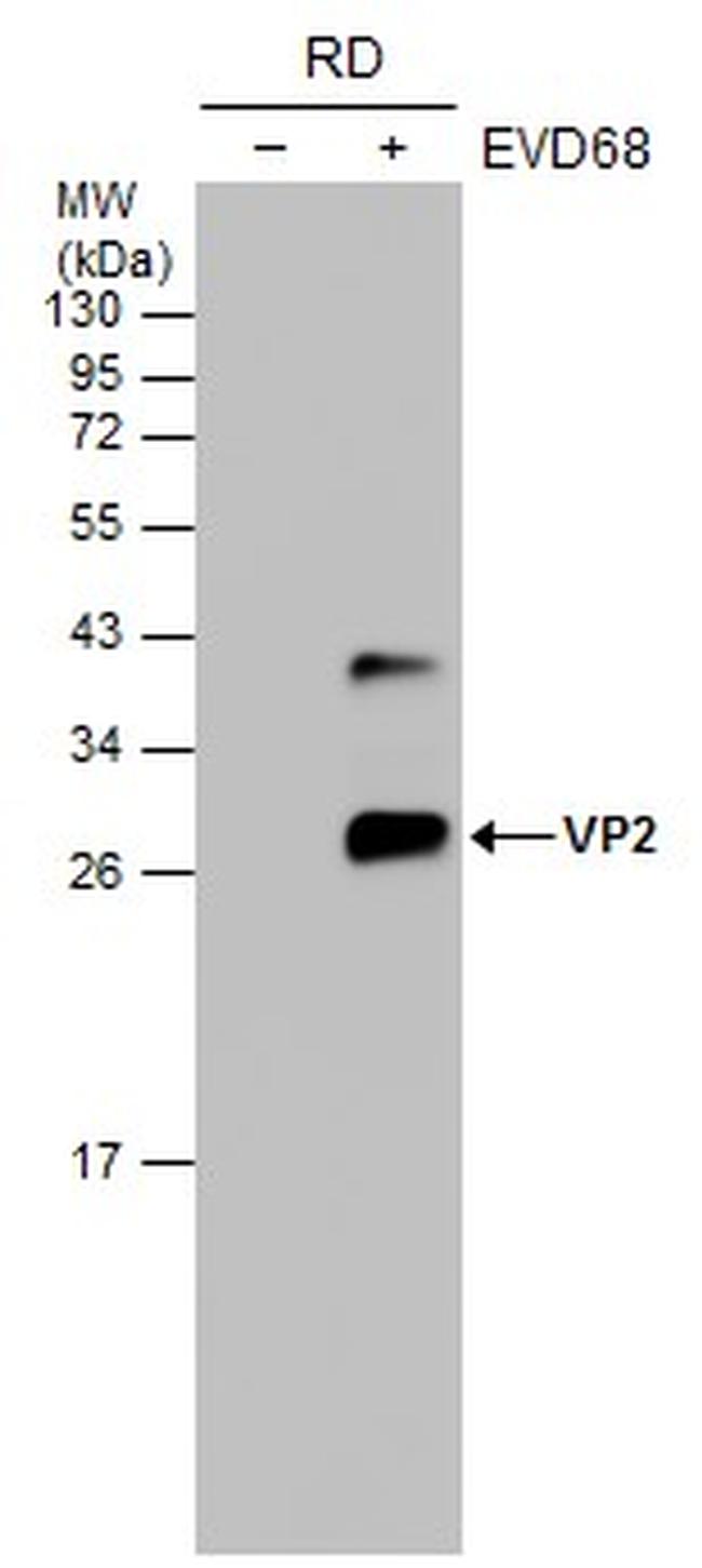 Enterovirus D68 VP2 Antibody in Western Blot (WB)
