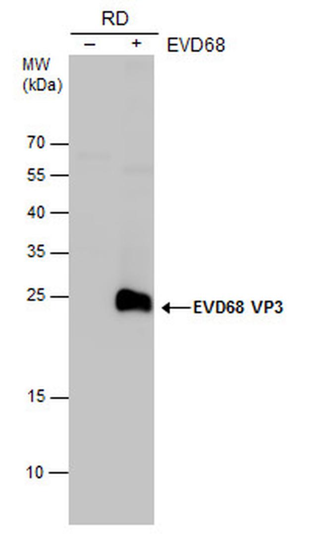 Enterovirus D68 VP3 Antibody in Western Blot (WB)