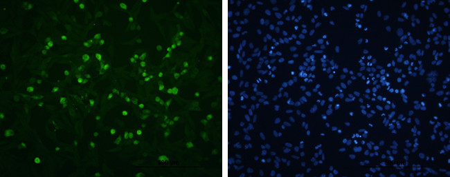 Enterovirus 71 VP1 Antibody in Immunocytochemistry (ICC/IF)