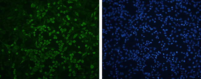 Enterovirus 71 VP1 Antibody in Immunocytochemistry (ICC/IF)