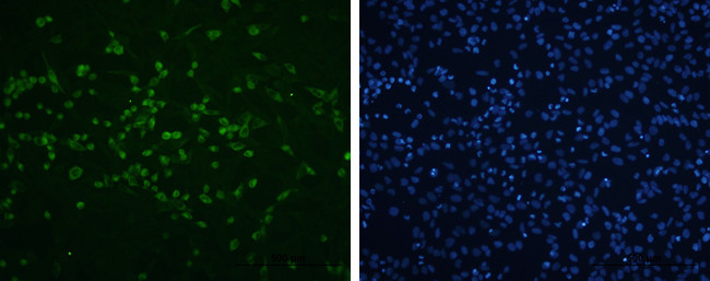 Enterovirus 71 VP2 Antibody in Immunocytochemistry (ICC/IF)