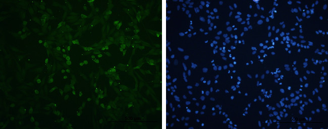 Enterovirus 71 VP3 Antibody in Immunocytochemistry (ICC/IF)