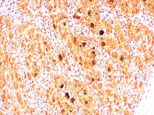 Enterovirus 71 2B Antibody in Immunohistochemistry (Paraffin) (IHC (P))