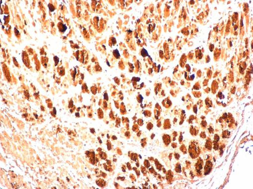Enterovirus 71 3AB Antibody in Immunohistochemistry (Paraffin) (IHC (P))