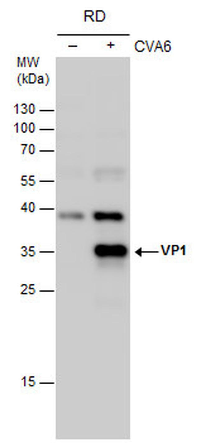 Coxsackievirus A6 VP1 Antibody in Western Blot (WB)