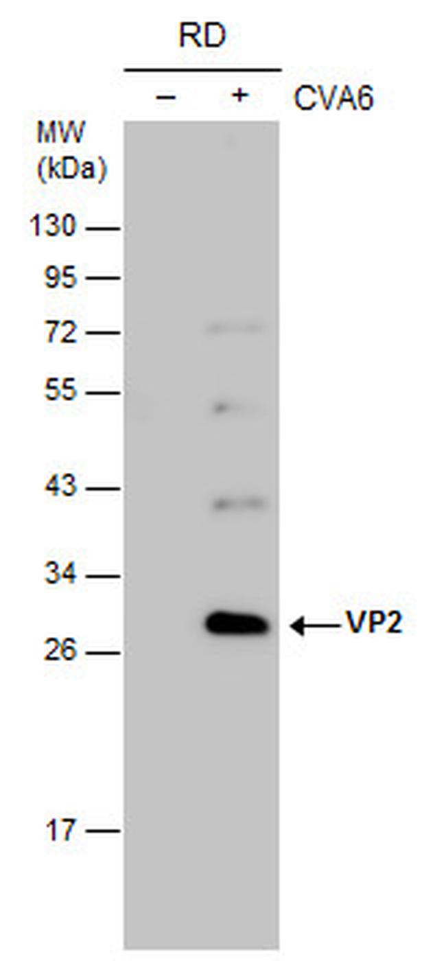 Coxsackievirus A6 VP2 Antibody in Western Blot (WB)