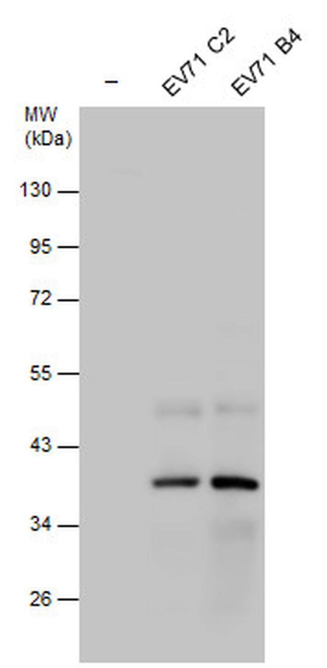 Enterovirus 71 2C Antibody in Western Blot (WB)