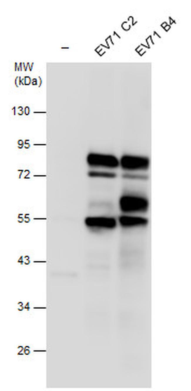 Enterovirus 71 3CD Antibody in Western Blot (WB)