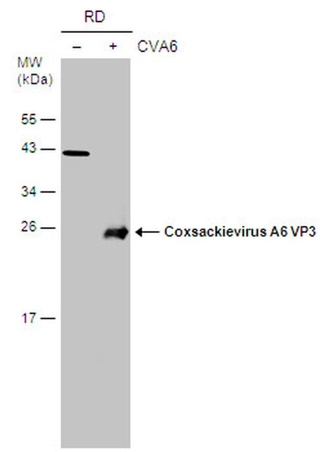 Coxsackievirus A6 VP3 Antibody in Western Blot (WB)