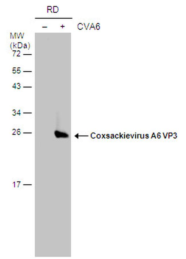 Coxsackievirus A6 VP3 Antibody in Western Blot (WB)