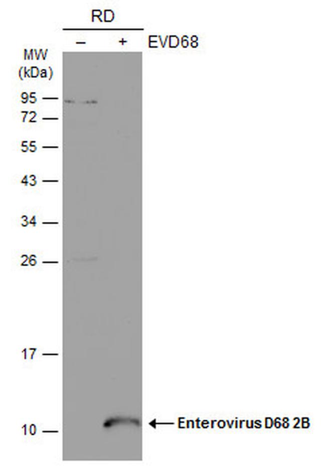Enterovirus D68 2B Antibody in Western Blot (WB)