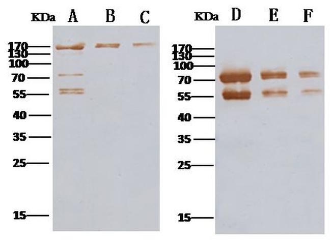 MERS Coronavirus Spike Protein S2 Antibody in Western Blot (WB)