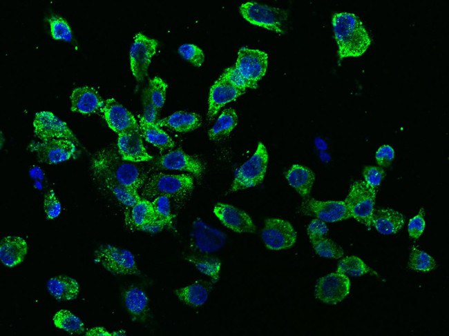 RANK (CD265) Antibody in Immunocytochemistry (ICC/IF)